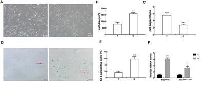 Analysis of Age-Related Circular RNA Expression Profiles in Mesenchymal Stem Cells of Rat Bone Marrow